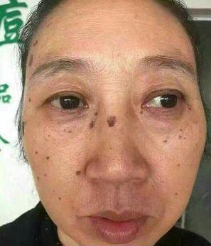 去老年斑的簡(jiǎn)單方法，重拾肌膚光彩的秘訣，去老年斑秘籍，重拾肌膚光彩的簡(jiǎn)易方法