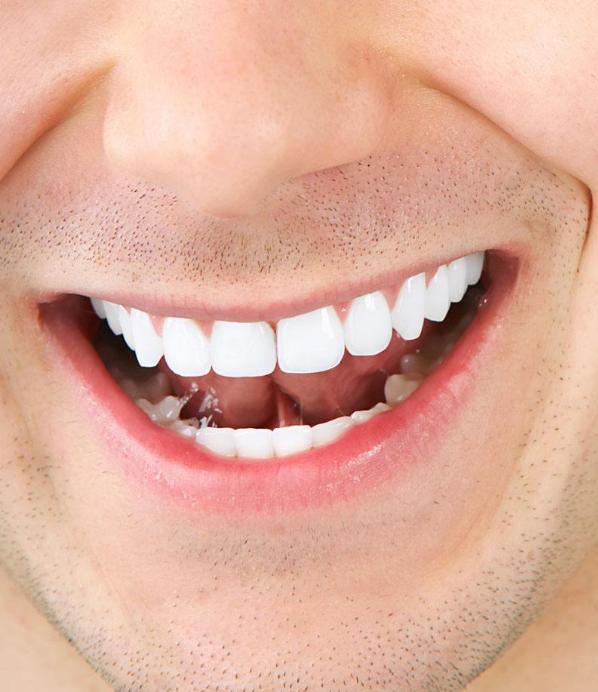 牙齒發(fā)黃變白小竅門，讓你的笑容更加自信璀璨，牙齒美白小竅門，重拾自信璀璨笑容的秘訣