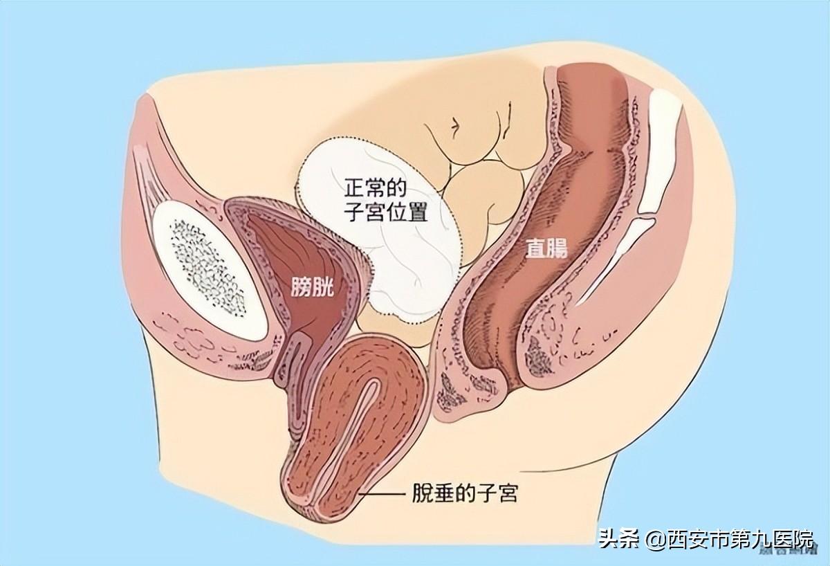 睪丸下垂松弛的原因及治療方法，睪丸下垂松弛的原因與治療方法解析