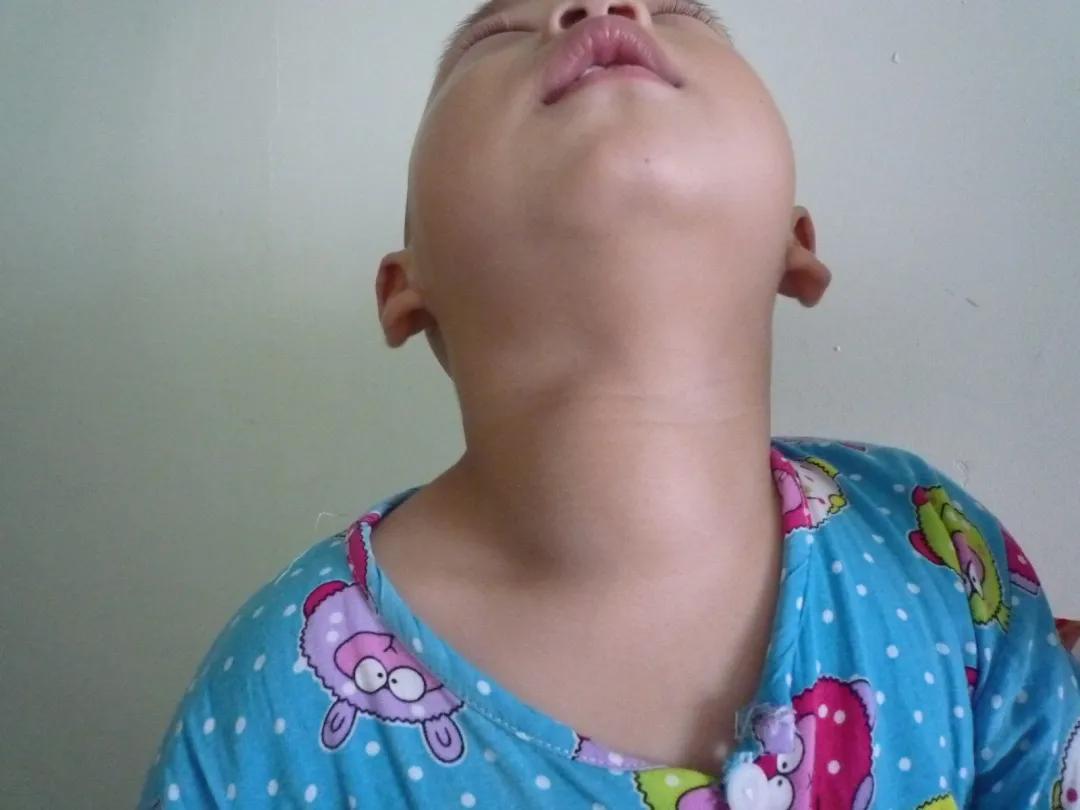 甲狀腺結(jié)節(jié)應(yīng)該掛什么科？一文詳解助您精準(zhǔn)就醫(yī)，甲狀腺結(jié)節(jié)詳解，該掛什么科？精準(zhǔn)就醫(yī)指南