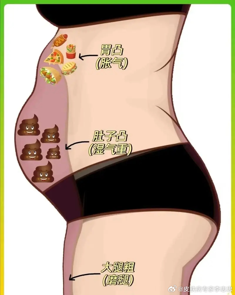 肚子大是濕氣重的原因嗎，肚子大是濕氣重引起的嗎？