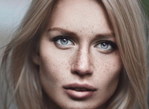 長黃褐斑的主要原因，黃褐斑成因揭秘，主要誘因解析