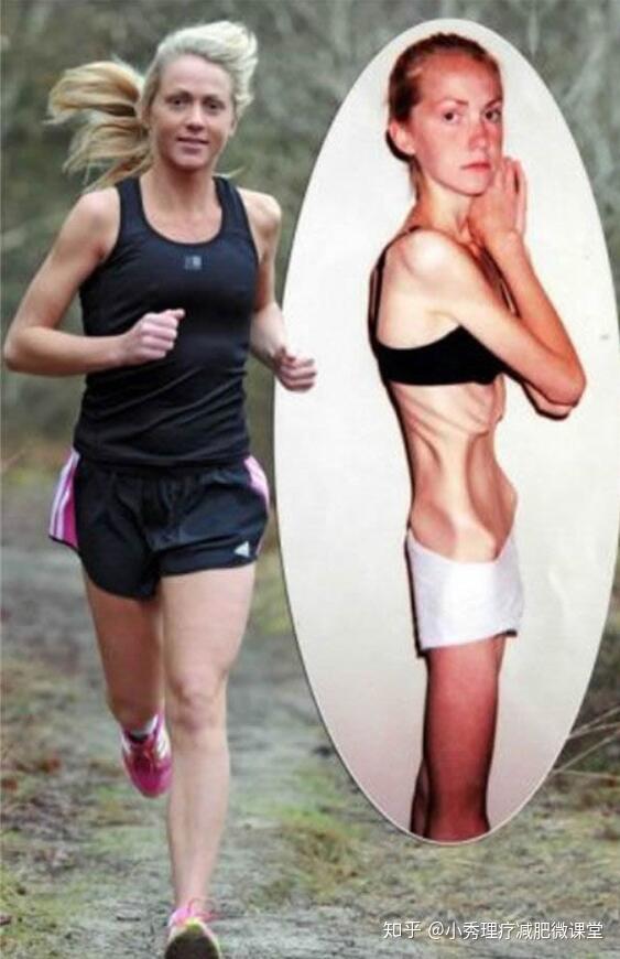 厭食癥的十大前兆，識(shí)別并預(yù)防的早期跡象，厭食癥的早期識(shí)別與預(yù)防，十大前兆詳解