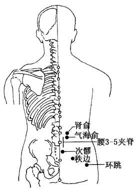 坐骨神經(jīng)痛的治療方法，哪種方式能最快緩解你的疼痛？，坐骨神經(jīng)痛快速緩解方法與治療方式探討