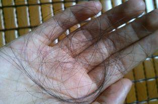 為什么有錢人不去植發(fā)，深度解析背后的原因，深度解析，有錢人為什么不去植發(fā)的原因