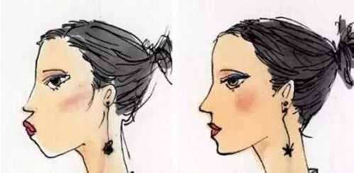 鼻子整形后能否永久保持？全面解析鼻子整形手術(shù)的持久性，鼻子整形手術(shù)的持久性與永久保持的可能性解析