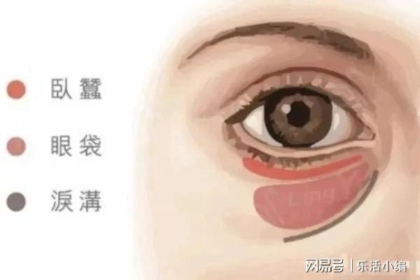 眼袋切除手術(shù)費用詳解，價格因素與如何選擇合適的手術(shù)方案，眼袋切除手術(shù)費用解析，了解價格因素與選擇最佳手術(shù)方案