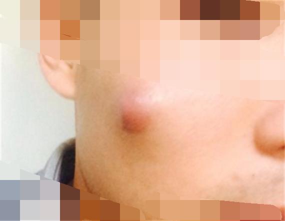 臉上一摸全是小顆粒，原因解析與應對方法，臉部小顆粒密布，原因解析及應對方法