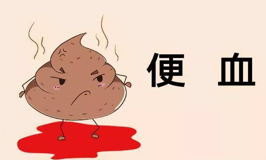 大便噴血滴鮮血無痛感，揭示潛在的健康問題，大便無痛性出血，揭示潛在健康問題的警示信號